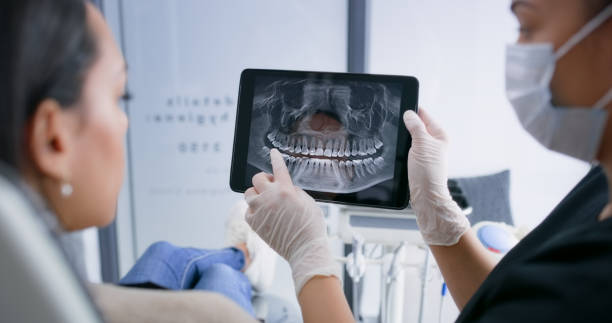 Best Emergency Dentist for Lost Fillings or Crowns in Parsippany, NJ